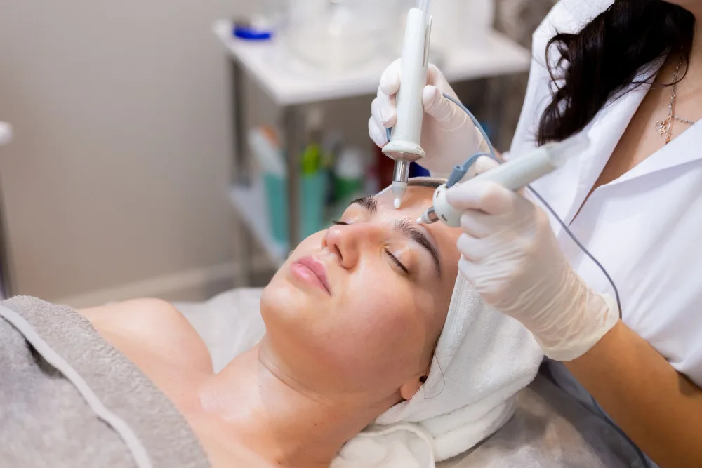 RF Microneedling