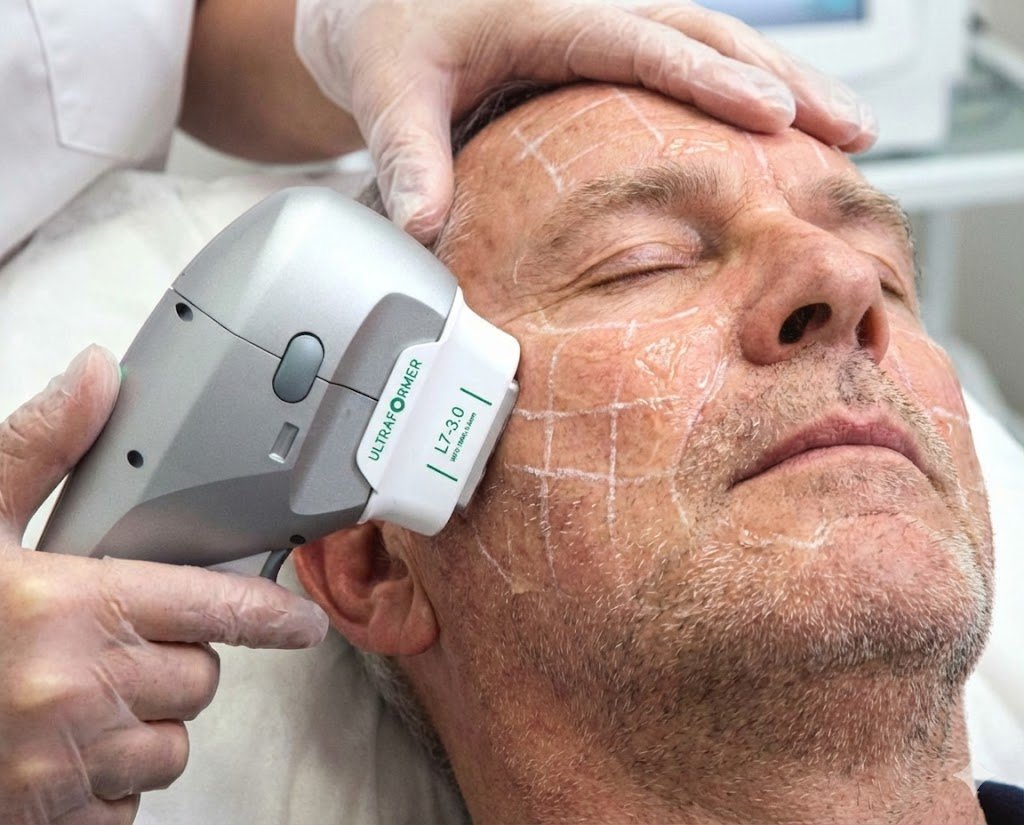 HIFU Treatment