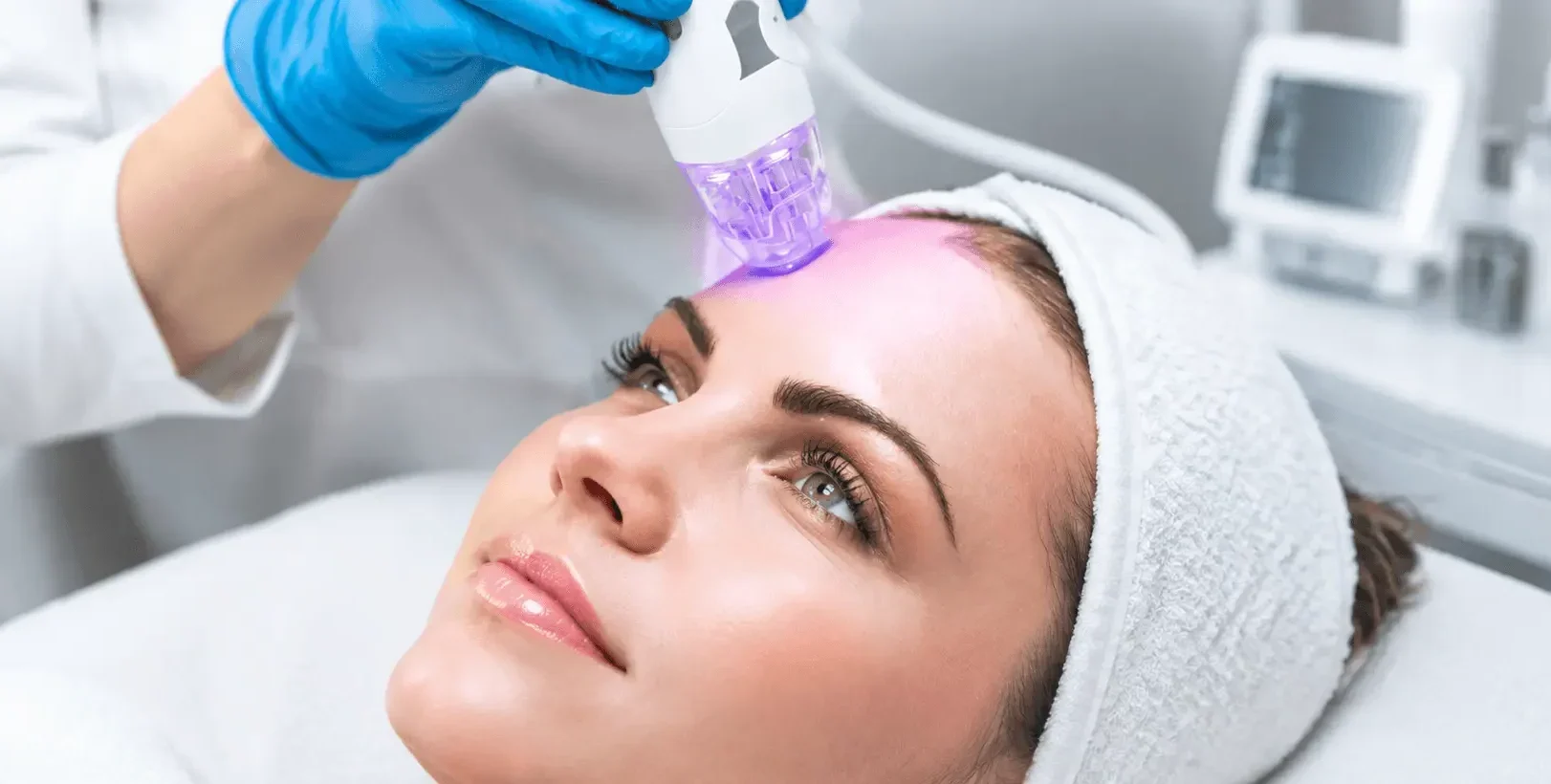 RF Microneedling
